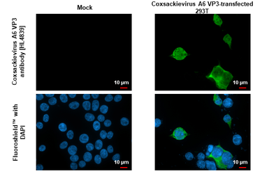 Anti-Coxsackievirus A6 VP3 antibody [HL4839] used in Immunocytochemistry/ Immunofluorescence (ICC/IF). GTX644902